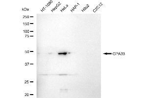 anti-Glycoprotein A33 (Transmembrane) (GPA33) antibody