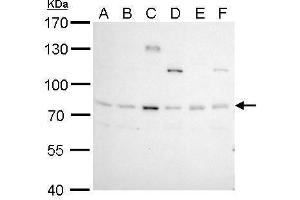 WB Image BCL6 antibody [N2C1], Internal detects BCL6 protein by Western blot analysis.