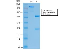 SDS-PAGE Analysis Purified CFTR Rabbit Recombinant Monoclonal Antibody (CFTR/2290R).