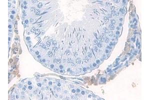 Detection of MEC in Rat Testis Tissue using Polyclonal Antibody to Mucosae Associated Epithelia Chemokine (MEC) (Mucosae Associated Epithelia Chemokine (AA 29-131) anticorps)