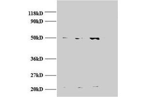 Western blot All lanes: AP2M1 antibody at 2 μg/mL Lane 1: Jurket whole cell lysate Lane 2: U87 whole cell lysate Lane 3: U251 whole cell lysate Secondary Goat polyclonal to rabbit IgG at 1/15000 dilution Predicted band size: 50 kDa Observed band size: 50, 22 kDa