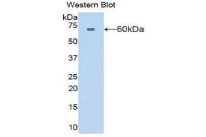 Western Blotting (WB) image for anti-Amylase 1, Salivary (AMY1) (AA 16-511) antibody (ABIN2117289) (Alpha-amylase 1 anticorps  (AA 16-511))