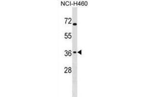 Western Blotting (WB) image for anti-ST6 (Alpha-N-Acetyl-Neuraminyl-2,3-beta-Galactosyl-1,3)-N-Acetylgalactosaminide alpha-2,6-Sialyltransferase 4 (ST6GALNAC4) antibody (ABIN3000613)