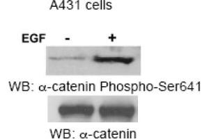 Image no. 1 for anti-Catenin (Cadherin-Associated Protein), alpha 1, 102kDa (CTNNA1) (Ser641) antibody (ABIN319361) (CTNNA1 anticorps  (Ser641))