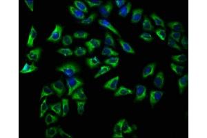 Immunofluorescence staining of Hela cells with ABIN7145154 at 1:66, counter-stained with DAPI. (CD72 anticorps  (AA 150-208))