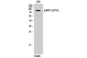 Western Blotting (WB) image for anti-Aconitase 1 (ACO1) (pSer711) antibody (ABIN3182636)