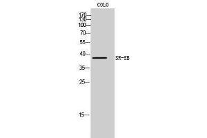 anti-5-Hydroxytryptamine (serotonin) Receptor 5B (HTR5B) (C-Term) antibody