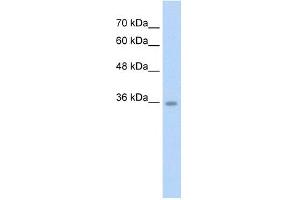 WB Suggested Anti-C6orf134 Antibody Titration:  2. (Chromosome 6 Open Reading Frame 134 (C6orf134) (N-Term) anticorps)