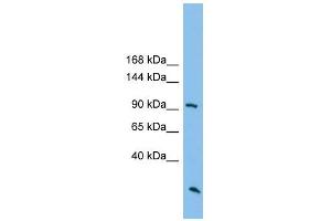 ARHGAP30 antibody used at 1 ug/ml to detect target protein. (ARHGAP30 anticorps  (N-Term))