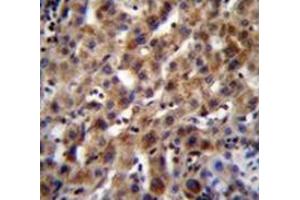 Immunohistochemistry analysis in human liver tissue (Formalin-fixed, Paraffin-embedded) using SPACA5B Antibody (N-term), followed by peroxidase conjugation of the secondary antibody and DAB staining. (SPACA5B anticorps  (N-Term))