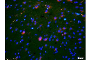 Formalin-fixed and paraffin-embedded rat brain labeled with Anti-OB/CDH11/OB-Cadherin Polyclonal Antibody, Unconjugated (ABIN1387539) 1:200, overnight at 4°C, The secondary antibody was Goat Anti-Rabbit IgG, Cy3 conjugated used at 1:200 dilution for 40 minutes at 37°C.