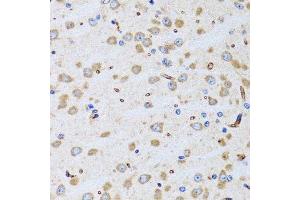 Immunohistochemistry of paraffin-embedded rat brain using PTRH2 antibody.