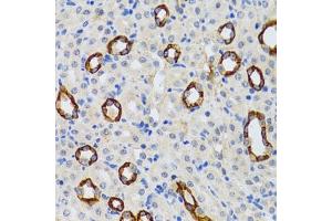 Immunohistochemistry of paraffin-embedded rat kidney using GABARAP antibody (ABIN6129966, ABIN6140874, ABIN6140877 and ABIN6221250) at dilution of 1:100 (40x lens). (GABARAP anticorps  (AA 1-117))