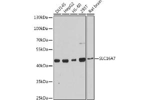 Western blot analysis of extracts of various cell lines, using SLC16 antibody (ABIN3017189, ABIN3017190, ABIN3017191 and ABIN6219987) at 1:3000 dilution.