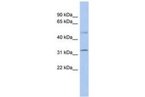 Image no. 1 for anti-Suppressor of Fused Homolog (SUFUH) (AA 215-264) antibody (ABIN6742334) (SUFUH anticorps  (AA 215-264))