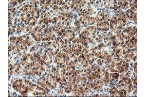 Image no. 1 for anti-1-Acylglycerol-3-Phosphate O-Acyltransferase 5 (Lysophosphatidic Acid Acyltransferase, Epsilon) (AGPAT5) antibody (ABIN1496498)