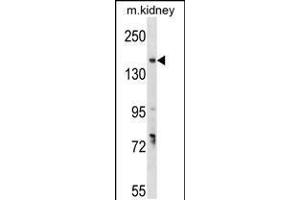 Western blot analysis in mouse kidney tissue lysates (35ug/lane). (GREB1 anticorps  (AA 1417-1446))