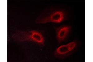 ABIN6267565 staining HeLa cells treated with PMA 125ng/ml 30' by ICC/IF. (14-3-3 zeta anticorps  (pSer58))