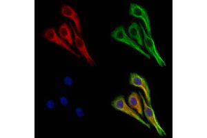 ABIN7094824 and ABIN7098875 staining Hela cells by IF/ICC.