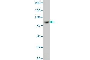 RPS6KA6 monoclonal antibody (M05A), clone 3E2.