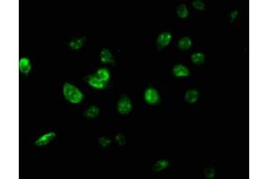 Immunofluorescence staining of A549 cells with ABIN7174336 at 1:267, counter-stained with DAPI. (USP46 anticorps  (AA 66-166))