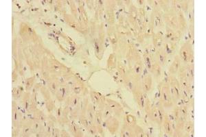 Immunohistochemistry of paraffin-embedded human heart tissue using ABIN7165964 at dilution of 1:100 (PPM1M anticorps  (AA 1-247))
