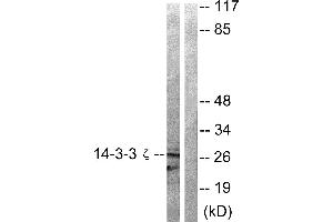 Western blot analysis of extracts from 293 cells treated with Forskolin (40nM, 30min) using 14-3-3 ζ (Ab-58) antibody (#B0001, Linand 2). (14-3-3 zeta anticorps  (Ser58))