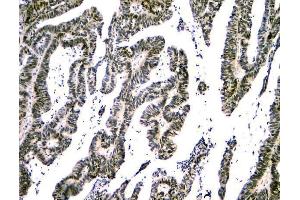 IHC analysis of NFIA using anti-NFIA antibody (ABIN6719349).