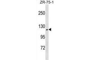 Western Blotting (WB) image for anti-Zinc Fingers and Homeoboxes 2 (ZHX2) antibody (ABIN3000459)