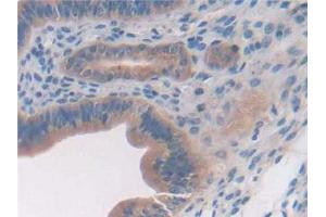 Detection of GPC3 in Mouse Uterus Tissue using Polyclonal Antibody to Glypican 3 (GPC3) (Glypican 3 anticorps  (AA 344-559))