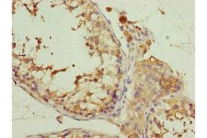 Immunohistochemistry of paraffin-embedded human testis tissue using ABIN7152171 at dilution of 1:100 (Eukaryotic Translation Initiation Factor 3, Subunit M (EIF3M) (AA 1-374) anticorps)