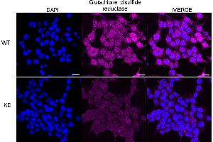 Immunocytochemical staining of HeLa cells using Glutathione-disulfide reductase antibody (ABIN7798754), 1:1,000), Top panel: wild-type (WT), Bottom panal: Glutathione-disulfide reductase shRNA knockdown (KD). (Recombinant Glutathione Reductase anticorps)