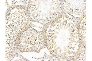 ABIN6260422 and ABIN6268873 at 1/100 staining Rat testis tissue by IHC-P.