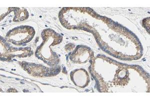 ABIN6273587 at 1/100 staining Human prostate tissue by IHC-P.
