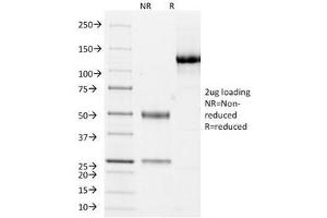 SDS-PAGE Analysis of Purified, BSA-Free Cytokeratin 10/13 Antibody (clone DE-K13). (Keratin 10/13 anticorps)