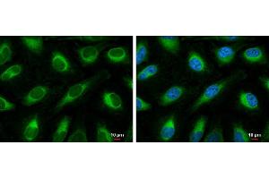 ICC/IF Image FACL4 antibody [C3], C-term detects FACL4 protein at endoplasmic reticulum by immunofluorescent analysis.