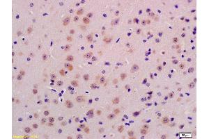 Formalin-fixed and paraffin embedded mouse brain labeled with Anti-PPT1 Polyclonal Antibody, Unconjugated (ABIN718946) at 1:200 followed by conjugation to the secondary antibody and DAB staining (PPT1 anticorps  (AA 188-290))