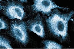 Immunofluorescence staining of human endothelial cells.