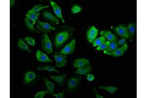 Immunofluorescence staining of A549 cells with ABIN7142230 at 1:530, counter-stained with DAPI.