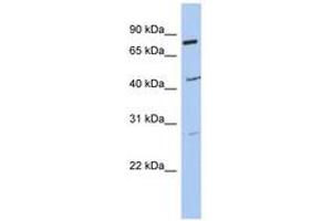 CCDC63 抗体  (AA 215-264)
