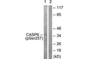 Western blot analysis of extracts from 293 cells treated with Etoposide 25uM 60', using Caspase 6 (Phospho-Ser257) Antibody. (Caspase 6 anticorps  (pSer257))