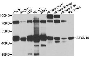 Western blot analysis of extracts of various cells, using ATXN10 antibody. (Ataxin 10 anticorps)