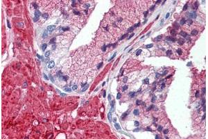 Human Prostate (formalin-fixed, paraffin-embedded) stained with TRAF2 antibody ABIN297934 at 5 ug/ml followed by biotinylated anti-mouse IgG secondary antibody ABIN481714, alkaline phosphatase-streptavidin and chromogen. (TRAF2 anticorps  (AA 205-222))