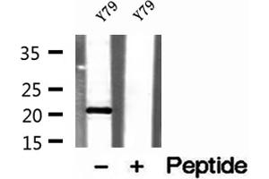 Western blot analysis of extracts of Y79 cells, using TAF12 antibody.