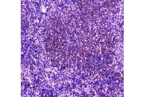 IHC analysis of PLCG 2 using anti-PLCG 2 antibody .