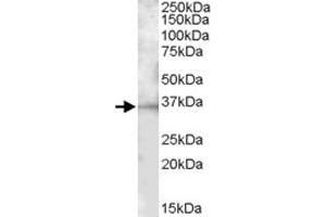 BTLA polyclonal antibody  (1 ug/mL) staining of mouse spleen lysate (35 ug protein in RIPA buffer). (BTLA anticorps)