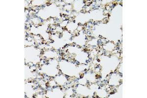 Immunohistochemistry of paraffin-embedded mouse lung using TLR1 Rabbit pAb (ABIN3023654, ABIN3023655, ABIN3023656 and ABIN6214092) at dilution of 1:100 (40x lens).
