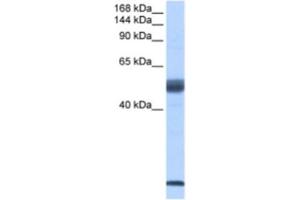 Western Blotting (WB) image for anti-Pre-mRNA Branch Site Protein p14 (SF3B14) antibody (ABIN2462263) (Pre-mRNA Branch Site Protein p14 (SF3B14) anticorps)