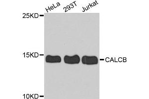 Western blot analysis of extracts of various cell lines, using CALCB antibody. (CALCB anticorps)