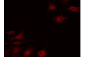 ABIN6267673 staining HepG2 by IF/ICC.